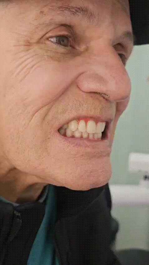 Resultado Dental - Después