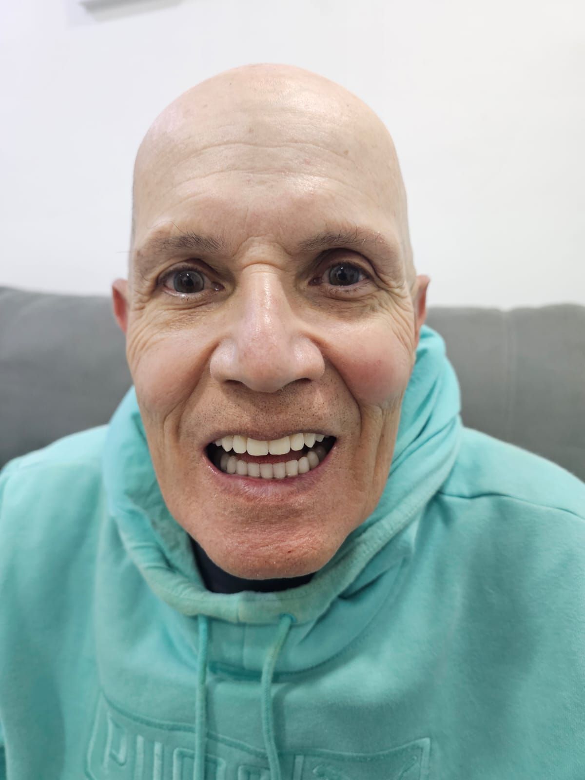 Resultado Dental - Antes